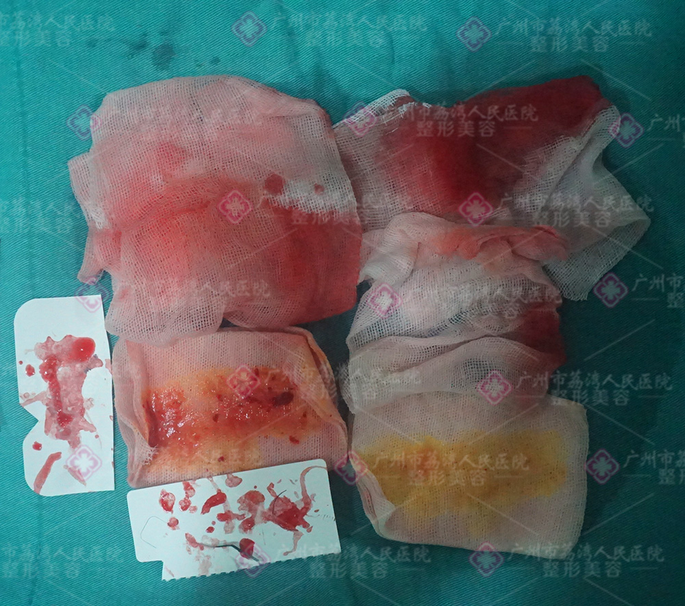 水分子丰体针为什么对健康有害